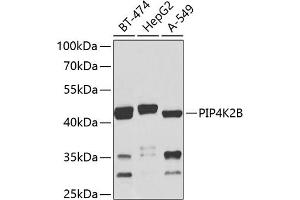 Western blot analysis of extracts of various cell lines, using PIP4K2B antibody (ABIN6130647, ABIN6145676, ABIN6145679 and ABIN6224039) at 1:1000 dilution. (PIP4K2B 抗体  (AA 1-270))