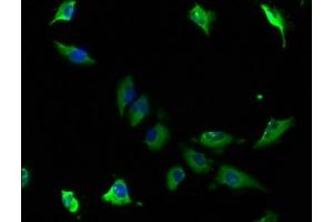 Immunofluorescence staining of U251 cells with ABIN7143354 at 1:100, counter-stained with DAPI. (CAP1 抗体  (AA 22-157))