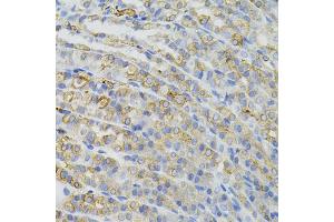 Immunohistochemistry of paraffin-embedded mouse stomach using CBL antibody (ABIN5995395) (40x lens). (CBL 抗体)