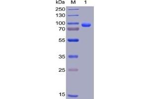 Human CD138, hFc-His Tag on SDS-PAGE under reducing condition. (Syndecan 1 Protein (SDC1) (Fc-His Tag))