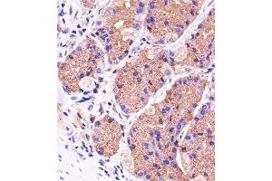 Immunohistochemical analysis of paraffin-embedded H. (PINK1 抗体)