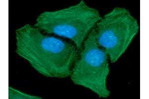 ICC/IF analysis of ACTA2 in HeLa cells line, stained with DAPI (Blue) for nucleus staining and monoclonal anti-human ACTA2 antibody (1:100) with goat anti-mouse IgG-Alexa fluor 488 conjugate (Green).