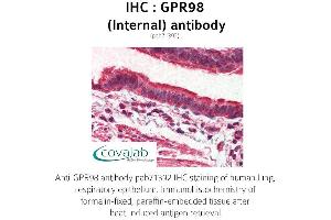 Image no. 1 for anti-G Protein-Coupled Receptor 98 (Gpr98) (Internal Region) antibody (ABIN1735202) (Gpr98 抗体  (Internal Region))