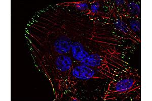 Phosphotyrosine pattern in HeLa cells as revealed by P-Tyr-01 antibody-Alexa Fluor ®  488 (green). (Phosphotyrosine 抗体)