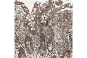Immunohistochemical staining of human colon with PI4K2B polyclonal antibody  shows moderate cytoplasmic and membranous positivity in glandular cells at 1:50-1:200 dilution. (PI4K2B 抗体)
