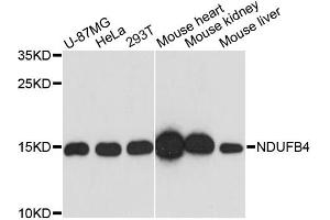 Western blot analysis of extracts of various cell lines, using NDUFB4 antibody. (NDUFB4 抗体)
