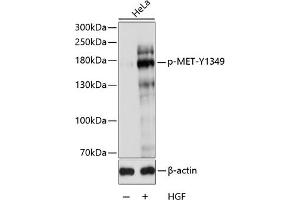 Western blot analysis of extracts of HeLa cells, using Phospho-MET-Y1349 antibody (ABIN3019529, ABIN3019530, ABIN3019531 and ABIN6225449) at 1:1000 dilution. (c-MET 抗体  (pTyr1349))