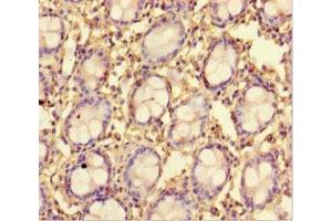 Immunohistochemistry of paraffin-embedded human colon tissue using ABIN7173015 at dilution of 1:100 (TMPRSS7 抗体  (Ser7))