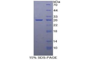 SDS-PAGE analysis of Human LOX1 Protein. (OLR1 蛋白)