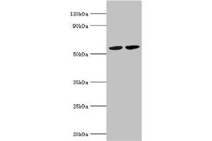 Western blot All lanes: A/G-specific adenine DNA glycosylase antibody at 5 μg/mL Lane 1: Hela whole cell lysate Lane 2: Jurakt whole cell lysate Secondary Goat polyclonal to rabbit IgG at 1/10000 dilution Predicted band size: 61, 60, 59, 58 kDa Observed band size: 61 kDa (MUTYH 抗体  (AA 1-265))