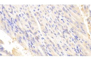 Detection of MYO1E in Mouse Stomach Tissue using Polyclonal Antibody to Myosin IE (MYO1E)