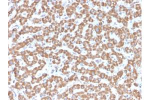 Formalin-fixed, paraffin-embedded human Liver stained with Prohibitin Mouse Monoclonal Antibody (PHB/3229). (Prohibitin 抗体  (AA 167-261))