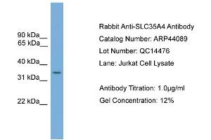 WB Suggested Anti-SLC35A4  Antibody Titration: 0. (SLC35A4 抗体  (Middle Region))