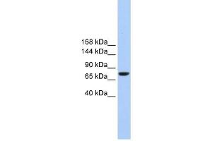 TMC2 antibody used at 1 ug/ml to detect target protein. (Tmc2 抗体  (Middle Region))
