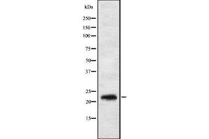 Western blot analysis IL17C using HT29 whole cell lysates (IL17C 抗体  (Internal Region))