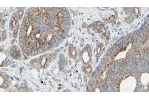 ABIN6276332 at 1/100 staining Human prostate tissue by IHC-P. (NEFL 抗体  (N-Term))