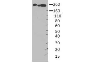 MYH9 antibody - middle region  validated by WB using Hek 293 Whole Cell Lysate at 1:4,000. (Myosin 9 抗体  (Middle Region))