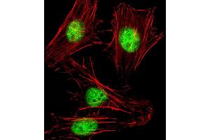 Immunofluorescent analysis of 4 % paraformaldehyde-fixed, 0. (SNW1 抗体  (AA 464-497))