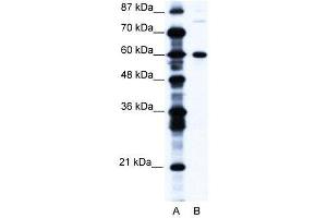 WB Suggested Anti-CNOT3 AntibodyTitration: 1. (CNOT3 抗体  (N-Term))
