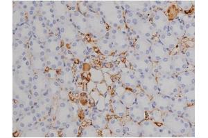 Immunohistochemistry (IHC) image for anti-zeta-Chain (TCR) Associated Protein Kinase 70kDa (ZAP70) (pTyr319) antibody (ABIN6255884)