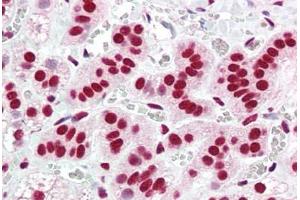 Human Adrenal (formalin-fixed, paraffin-embedded) stained with ACIN1 antibody ABIN461881 at 5 ug/ml followed by biotinylated goat anti-rabbit IgG secondary antibody ABIN481713, alkaline phosphatase-streptavidin and chromogen. (ACIN1 抗体  (AA 775-789))