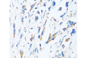 Immunohistochemistry (Paraffin-embedded Sections) (IHC (p)) image for anti-BCL2-Associated Athanogene 3 (BAG3) antibody (ABIN7258158)
