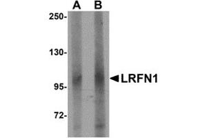 Western Blotting (WB) image for anti-Leucine Rich Repeat and Fibronectin Type III Domain Containing 1 (LRFN1) (C-Term) antibody (ABIN1030489) (LRFN1 抗体  (C-Term))