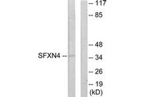 Western blot analysis of extracts from HuvEc cells, using SFXN4 Antibody. (Sideroflexin 4 抗体  (AA 1-50))