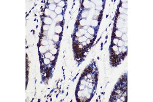 Immunohistochemistry of paraffin-embedded Human colon using SARNP Rabbit pAb (ABIN6130106, ABIN6147381, ABIN6147382 and ABIN6217793) at dilution of 1:100 (40x lens). (SARNP 抗体  (AA 1-210))