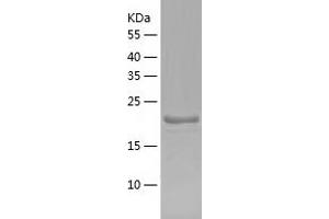 Western Blotting (WB) image for Interferon, gamma-Inducible Protein 30 (IFI30) (AA 58-232) protein (His tag) (ABIN7123508) (IFI30 Protein (AA 58-232) (His tag))
