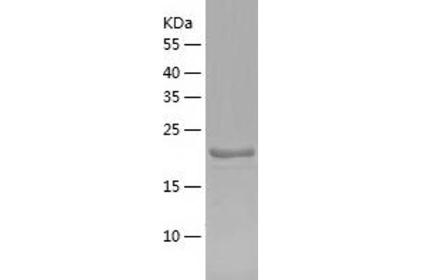 IFI30 Protein (AA 58-232) (His tag)