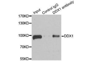 Immunoprecipitation analysis of 100ug extracts of 293T cells using 3ug DDX1 antibody. (DDX1 抗体  (AA 441-740))