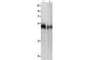 Gel: 10 % SDS-PAGE, Lysate: 50 μg, Lane 1-2: Human tongue tissue, Human laryngocarcinoma tissue, Primary antibody: ABIN7190003(BPIFB1 Antibody) at dilution 1/500, Secondary antibody: Goat anti rabbit IgG at 1/8000 dilution, Exposure time: 1 minute (BPIFB1 抗体)