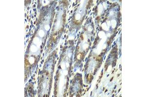 Immunohistochemistry of paraffin-embedded rat Intestine using Septin 7 antibody (ABIN1682655, ABIN3018092, ABIN3018093 and ABIN6220357) at dilution of 1:100 (40x lens). (7-Sep (AA 307-436) 抗体)