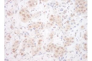 anti-Eyes Absent Homolog 3 (EYA3) (AA 1-30) antibody