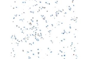 Immunocytochemistry (ICC) image for anti-SRY (Sex Determining Region Y)-Box 2 (SOX2) antibody (ABIN7449421) (SOX2 抗体)