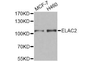 Western blot analysis of extracts of various cell lines, using ELAC2 Antibody. (ELAC2 抗体)