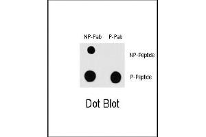 Dot blot analysis of anti-RAF1-p Phospho-specific Pab (ABIN389747 and ABIN2839678) on nitrocellulose membrane.