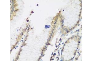 Immunohistochemistry of paraffin-embedded Human stomach using NAA50 Polyclonal Antibody at dilution of 1:200 (40x lens). (NAA50 抗体)