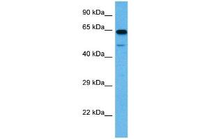 Western Blotting (WB) image for anti-Solute Carrier Family 1 (Glial High Affinity Glutamate Transporter), Member 2 (SLC1A2) (N-Term) antibody (ABIN2778148)