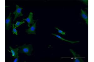 Immunofluorescence of monoclonal antibody to GPT2 on HeLa cell. (GPT2 抗体  (AA 358-456))