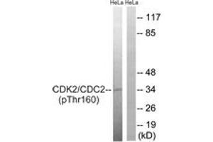 Western blot analysis of extracts from HeLa cells, using CDC2 (Phospho-Thr161) Antibody. (CDK1 抗体  (pThr161))