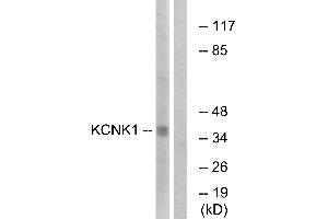 Western blot analysis of extracts from Jurkat cells, using KCNK1 antibody. (KCNK1 抗体  (Internal Region))