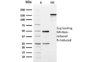 SDS-PAGE Analysis of Purified Spectrin alpha 1 Mouse Monoclonal Antibody (SPTA1/1810). (SPTA1 抗体  (AA 356-475))