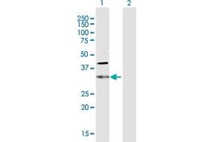 Western Blot analysis of CDC34 expression in transfected 293T cell line by CDC34 MaxPab polyclonal antibody. (CDC34 抗体  (AA 1-236))