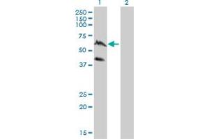 Western Blot analysis of PPIL4 expression in transfected 293T cell line by PPIL4 monoclonal antibody (M01), clone 1C10. (PPIL4 抗体  (AA 395-466))