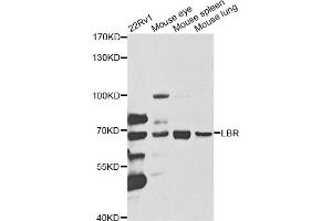 Western blot analysis of extracts of various cell lines, using LBR antibody (ABIN5973181) at 1/1000 dilution. (Lamin B Receptor 抗体)