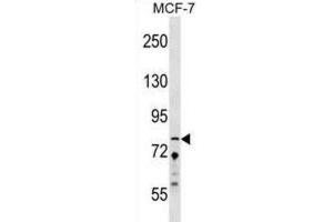 Western Blotting (WB) image for anti-Zinc Finger Protein 828 (ZNF828) antibody (ABIN2999729) (ZNF828 抗体)