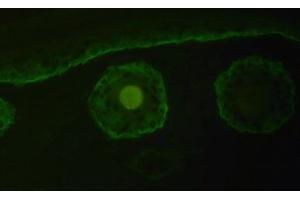 Immunofluorescence staining of Collagen type XVII alpha 1 chain with Cat. (COL17A1 抗体  (Chain alpha 1))