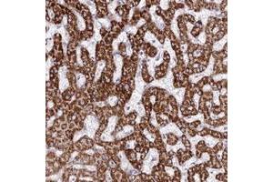 Immunohistochemical staining of human liver with CEP164 polyclonal antibody  shows strong cytoplasmic positivity in hepatocytes. (CEP164 抗体)